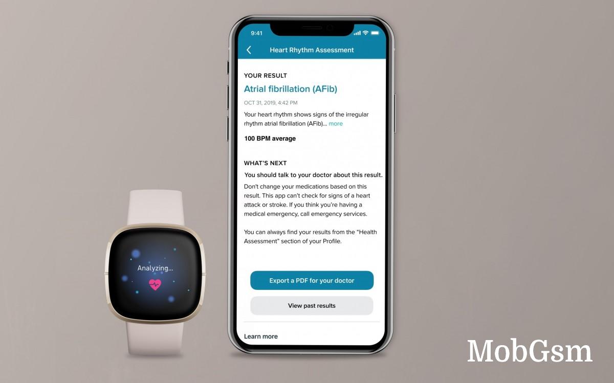 Fitbit Sense now measures ECG in US and Europe