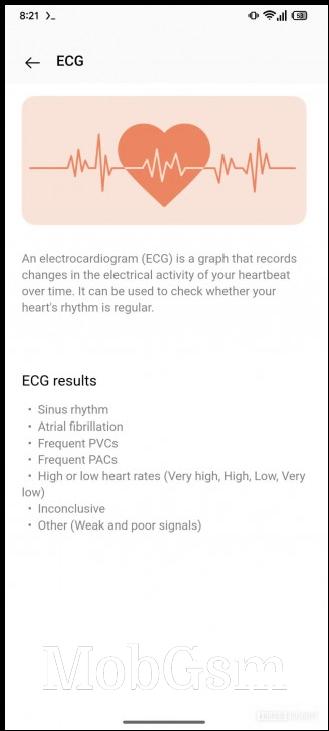 OnePlus Watch 3 ECG